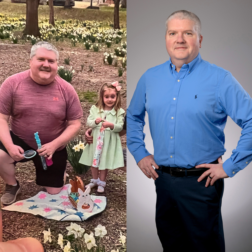 Joe Barnett with daughter in park before weight loss surgery and then after surgery.